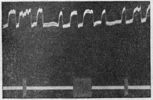 Фотография записи сигналов ИСЗ, сделаннная  В.H.Гончарским (UB5WF) с экрана двухшлейфового осциллографа, октябрь 1957 г.
